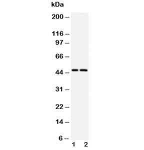 Western blot testing of Caspase-2 antibody and Lane 1: human CCRF-CEM; 2: human SMMC-7721 cell lysat