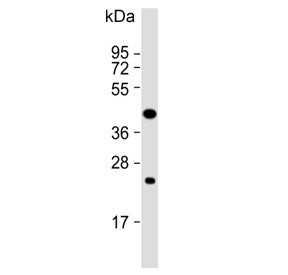 Western blot testing of human CCRF-CEM cell lysate with PTAR1 antibody. Expected molecular weight: 4