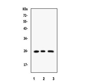 Western blot testing of 1) rat brain, 2) human Raji and 3) human SMMC lysate with RAB14 antibody. Ex
