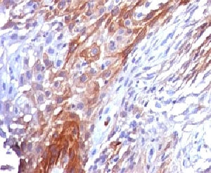 Cytokeratin 17 Antibody