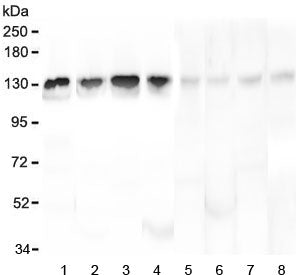 Western blot testing of human 1) HL-60, 2) K562, 3) ThP-1, 4) Caco-2, 5) rat liver, 6) mouse brain, 