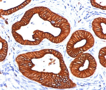 Cytokeratin 18 Antibody
