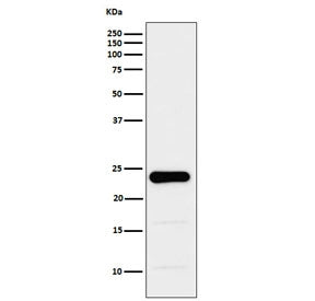 Western blot testing of human PC-3 cell lysate with GSTP1 antibody. Predicted molecular weight ~23 k