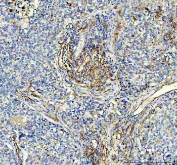Immunohistochemical staining of ACE using anti-ACE antibody. ACE was detected in a paraffin-embedded