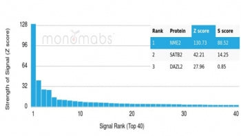 NME2 Antibody / Nucleoside diphosphate kinase B / NDKB
