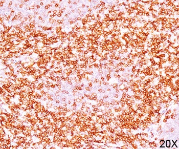 CD6 Antibody