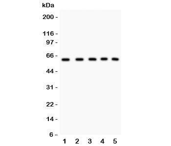 Western blot testing of LKB1 antibody and human samples 1: 293T; 2: HT1080; 3: SHG-44; 4: Jurkat; 5: