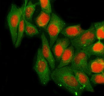 Immunofluorescent staining of FFPE human A549 cells with NTH1 antibody (red) and Beta Tubulin mAb (g