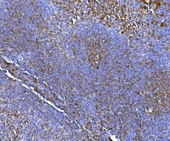 IHC staining of FFPE mouse spleen tissue with NOX2 antibody. HIER: boil tissue sections in pH8 EDTA 