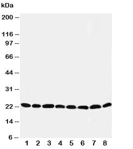 Western blot testing of Peroxiredoxin 5 antibody and Lane 1: rat brain; 2: (r) lung; 3: (r) liver; 4