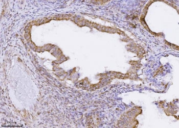 MPPB Antibody / PMPCB