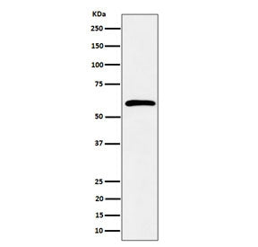 Western blot testing of human K562 cell lysate with SDC3 antibody. Predicted molecular weight ~46 kD