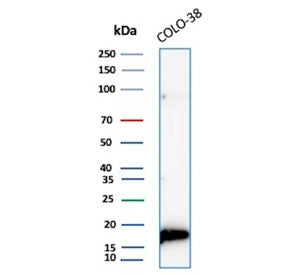 Western blot testing of human COLO-38 cell lysate with recombinant MLANA antibody (clone rMLANA/9404