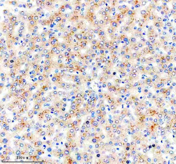 Immunohistochemical staining of NSUN6 using anti-NSUN6 antibody. NSUN6 was detected in a paraffin-em