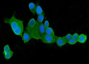 IF/ICC staining of FFPE human MCF7 cells with CLPX antibody (green) at 2ug/ml and DAPI nuclear stain