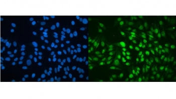 Immunofluorescent staining of FFPE human HeLa cells with MBD4 antibody (green) and DAPI nuclear stai