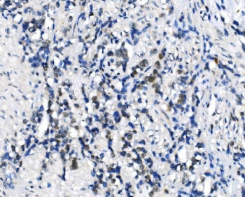 METTL3 Antibody / M6A