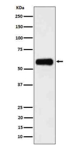 Western blot analysis of CD116 in human 293 cell lysate using CD116 antibody. A predominant band is 