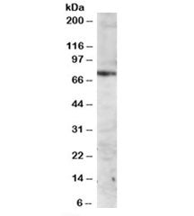 Western blot testing of Jurkat lysate with ITK antibody at 2ug/ml. Predicted molecular weight: ~72kD