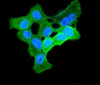 Immunofluorescent staining of FFPE human A431 cells with Enolase 1 antibody (green) and DAPI nuclear