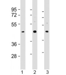 SAPCD2 Antibody / Suppressor APC domain containing 2