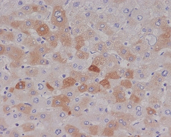 IHC staining of FFPE human liver with C Reactive Protein antibody. HIER: boil tissue sections in pH6