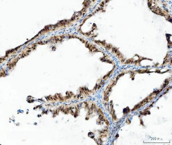 UBA6 Antibody / UBE1L2
