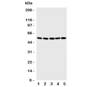 Western blot testing of SMAD1 antibody and Lane 1: SMMC-7721; 2: K562; 3: HT1080; 4: HeLa; 5: Jurkat