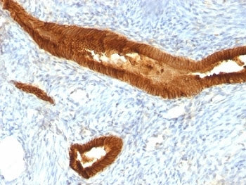 EpCAM Antibody