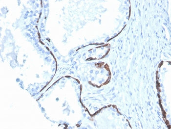 Cytokeratin 5/6 Antibody