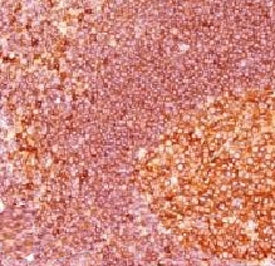 IHC staining of FFPE human tonsil tissue with MALT1 antibody (clone 4NMT-3). Required HIER: boil tis