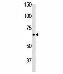 Glial fibrillary acidic protein antibody used in western blot to detect GFAP in mouse brain tissue l