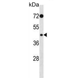 Western blot testing of human HeLa cell lysate with PHKG2 antibody. Predicted molecular weight ~44 k