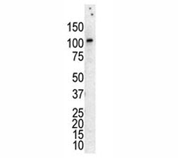 PKC nu Antibody