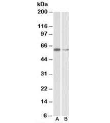 Western blot testing of HeLa [A] and K562 [B] nuclear lysates with ARIH2 antibody at 2ug/ml. Predict