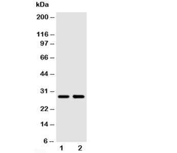 Western blot testing of SSX2 antibody and Lane 1: MCF-7; 2: HeLa cell lysate