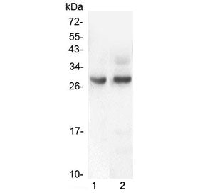 Western blot testing of 1) rat intestinal smooth muscle and 2) mouse intestinal smooth muscle lysate