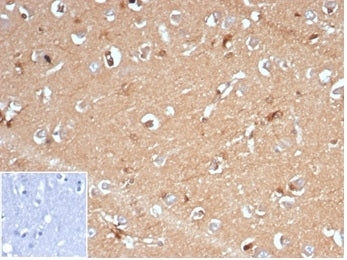 IHC staining of FFPE human brain tissue with recombinant AKR1B1 antibody (clone AKR1B1/7009R) at 2ug