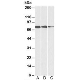 Western blot testing of A) HepG2, B) HeLa and C) MCF7 cell lysate with GRP78 antibody at 0.1ug/ml. P