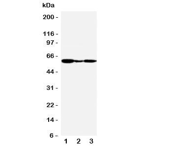 Western blot testing of GPR30 antibody and Lane 1: human COLO320; 2: human MCF-7; 3: monkey COS7 cel