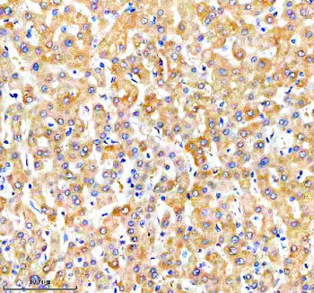 Immunohistochemical staining of NUDT7 using anti-NUDT7 antibody. NUDT7 was detected in a paraffin-em