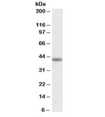 Western blot testing of human testis lysate with TAF7L antibody at 1ug/ml. Predicted molecular weigh