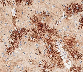 IHC testing of FFPE human brain tissue with OTUD3 antibody. HIER: steam section in pH6 citrate buffe