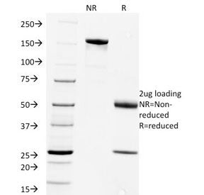 SDS-PAGE Analysis of Purified, BSA-Free Rabies Virus Antibody (clone Rab-50). Confirmation of Integr