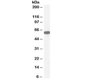 Western blot testing of human kidney lysate with Catalase antibody at 1ug/ml. Predicted molecular we