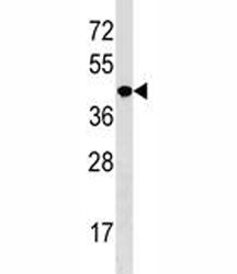 NKX2.5 antibody western blot analysis in mouse liver tissue lysate. Predicted molecular weight ~35kD
