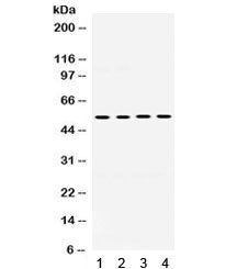 Western blot testing of mouse 1) testis, 2) NIH3T3, 3) HEPA and 4) rat NRK cell lysate with MMP8 ant