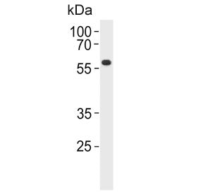 Western blot testing of human ZR-75-1 cell lysate with PPP2R2A antibody. Predicted molecular weight 