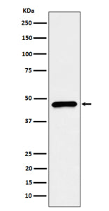 Western blot analysis of CECR5/HDHD5 expression in HepG2 cell lysate using HDHD5 antibody. Predicted