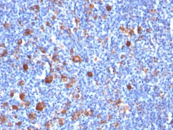 Fascin Antibody